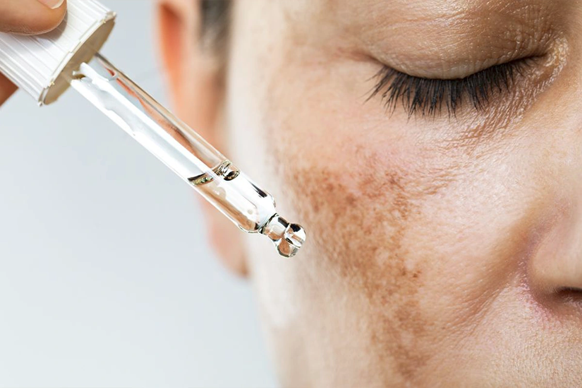 Pigmentation & Skin Tone img